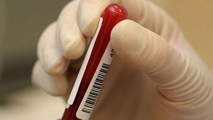 معرفی اولین آزمایش خون در بارداری